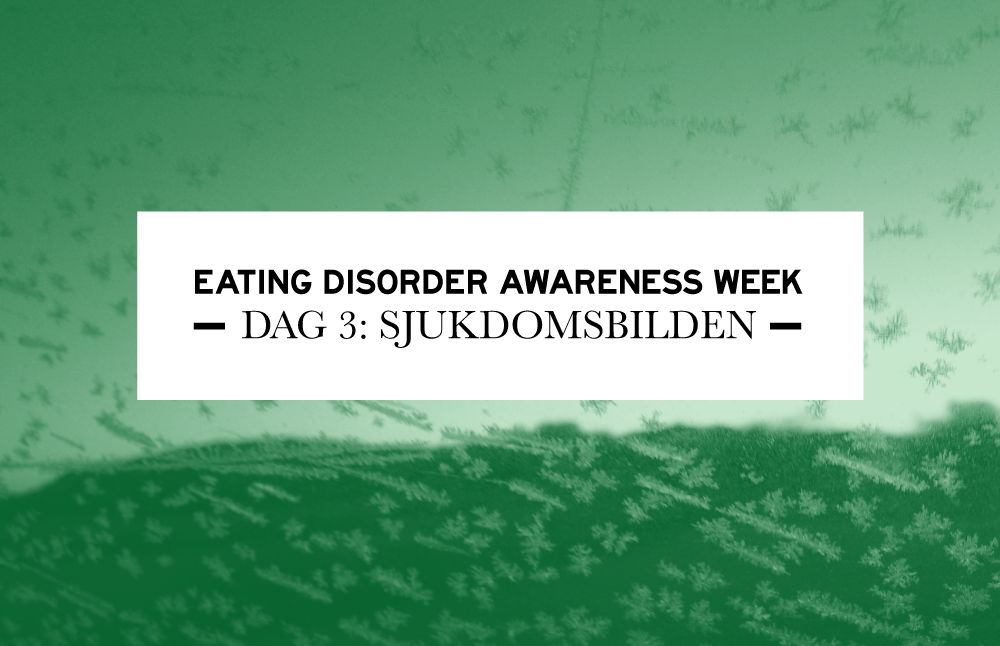 dag3
